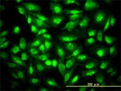 Immunocytochemistry/ Immunofluorescence: p27/Kip1 Antibody (4B4-E6) [H00001027-M01]