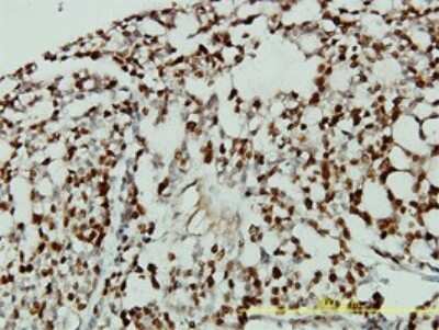 Immunohistochemistry-Paraffin: p27/Kip1 Antibody (4B4-E6) [H00001027-M01]