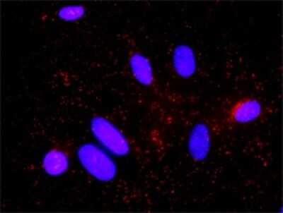 Proximity Ligation Assay: p27/Kip1 Antibody (4B4-E6) [H00001027-M01]