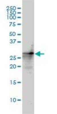 Western Blot: p27/Kip1 Antibody (4B4-E6) [H00001027-M01]