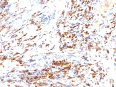 Immunohistochemistry-Paraffin: p27/Kip1 Antibody (DCS-72.F6 + KIP1/769) - Azide and BSA Free [NBP2-47771]