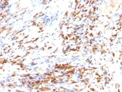 Immunohistochemistry-Paraffin: p27/Kip1 Antibody (DCS-72.F6 + KIP1/769) - IHC-Prediluted [NBP2-48401]