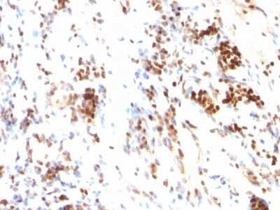 Immunohistochemistry-Paraffin: p27/Kip1 Antibody (DCS-72.F6) - Azide and BSA Free [NBP2-47770]