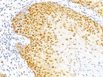 Immunohistochemistry-Paraffin: p27/Kip1 Antibody (DCS-72.F6) - IHC-Prediluted [NBP2-48400]