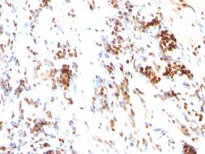 Immunohistochemistry-Paraffin: p27/Kip1 Antibody (DCS-72.F6) - IHC-Prediluted [NBP2-48400]