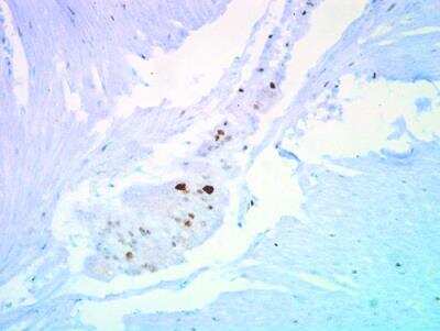 Immunohistochemistry-Paraffin: p27/Kip1 Antibody [NBP1-32213]