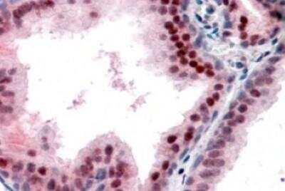 Immunohistochemistry-Paraffin: p27/Kip1 Antibody [NB100-2816]