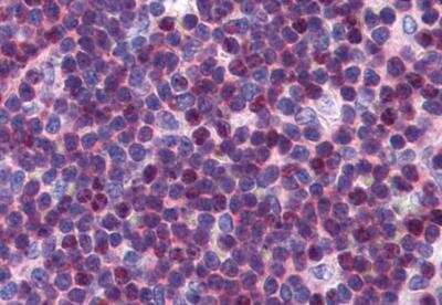 Immunohistochemistry-Paraffin: p27/Kip1 Antibody [NB100-2816]