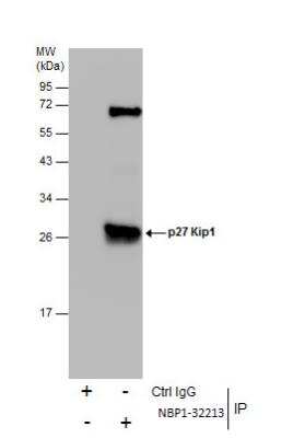 Immunoprecipitation: p27/Kip1 Antibody [NBP1-32213]