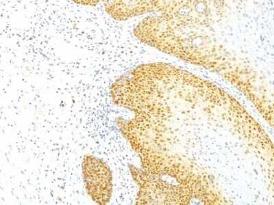 Immunohistochemistry-Paraffin: p27/Kip1 Antibody (KIP1/769) - IHC-Prediluted [NBP2-48399]