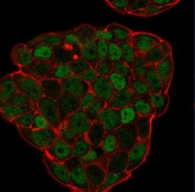 Immunocytochemistry/ Immunofluorescence: p27/Kip1 Antibody (KIP1/769) [NBP2-44495]