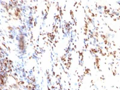 Immunohistochemistry-Paraffin: p27/Kip1 Antibody (KIP1/769) [NBP2-44495]