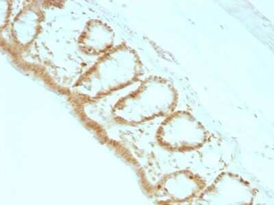 Immunohistochemistry-Paraffin: p27/Kip1 Antibody (KIP1/769) [NBP2-44495]