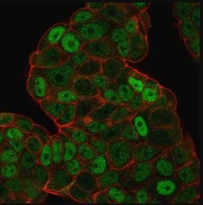 Immunocytochemistry/ Immunofluorescence: p27/Kip1 Antibody (SPM348) - Azide and BSA Free [NBP2-34766]