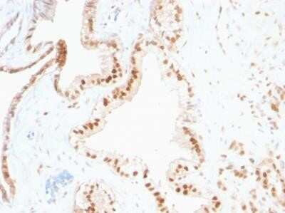 Immunohistochemistry-Paraffin: p27/Kip1 Antibody (SPM348) - IHC-Prediluted [NBP2-44494]