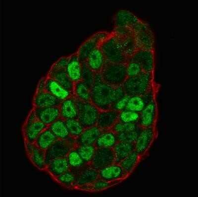 Immunocytochemistry/ Immunofluorescence: p27/Kip1 Antibody (SX53G8) - Azide and BSA Free [NBP2-34718]