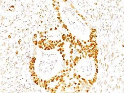 Immunohistochemistry-Paraffin: p27/Kip1 Antibody (SX53G8) - Azide and BSA Free [NBP2-34718]