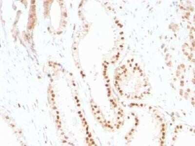 Immunohistochemistry-Paraffin: p27/Kip1 Antibody (SX53G8) - IHC-Prediluted [NBP2-44493]