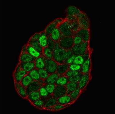 Immunocytochemistry/ Immunofluorescence: p27/Kip1 Antibody (SX53G8) [NBP2-32889]