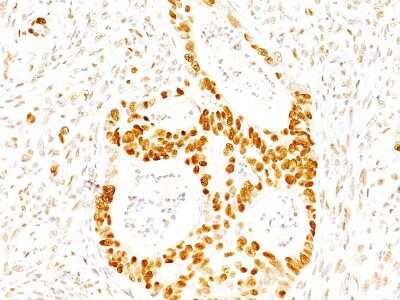 Immunohistochemistry-Paraffin: p27/Kip1 Antibody (SX53G8) [NBP2-32889]