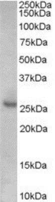 Western Blot: p27/Kip1 Antibody [NB100-2816]