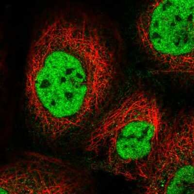 Immunocytochemistry/ Immunofluorescence: p33MONOX Antibody [NBP2-47341]