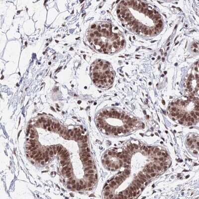 Immunohistochemistry: p33MONOX Antibody [NBP2-47341]