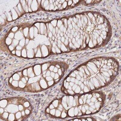 Immunohistochemistry-Paraffin: p33MONOX Antibody [NBP2-48891]