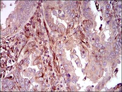 Immunohistochemistry: p38 alpha Antibody (10B11C8) - BSA Free [NBP2-37312]