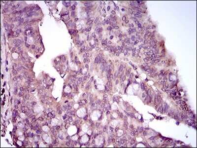 Immunohistochemistry-Paraffin: p38 alpha Antibody (8G4D11) - BSA Free [NBP2-37378]