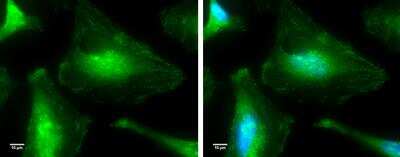 Immunocytochemistry/ Immunofluorescence: p38 alpha Antibody [NBP2-19662]
