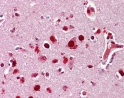 Immunohistochemistry-Paraffin: p38 alpha Antibody [NB100-56665]