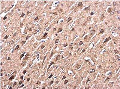 Immunohistochemistry-Paraffin: p38 alpha Antibody [NBP2-19662]