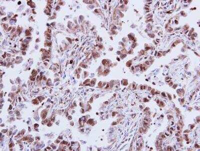 Immunohistochemistry-Paraffin: p38 alpha Antibody [NBP2-19662]