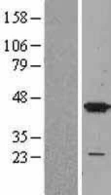 Western Blot: p38 alpha Overexpression Lysate [NBL1-12873]