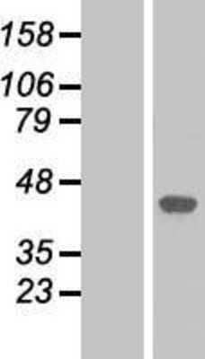 Western Blot: p38 alpha Overexpression Lysate [NBL1-12874]