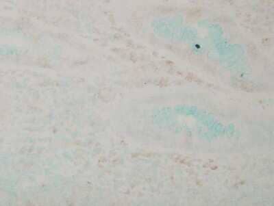 Immunohistochemistry: p38 alpha Antibody (9F12) [NB110-96875]