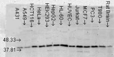 Western Blot: p38 alpha Antibody (9F12) [NB110-96875]