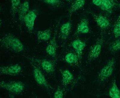 Immunocytochemistry/ Immunofluorescence: p38 beta/MAPK11 Antibody (E13-Q) [NBP3-08206]