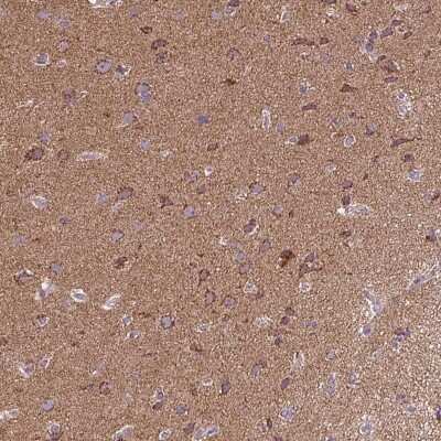 Immunohistochemistry: p38 beta/MAPK11 Antibody [NBP2-48826]