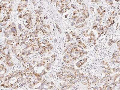 Immunohistochemistry-Paraffin: p38 beta/MAPK11 Antibody [NBP2-98810]