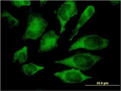 Immunocytochemistry/ Immunofluorescence: p38 delta/SAPK4 Antibody (1E11) [H00005603-M03]