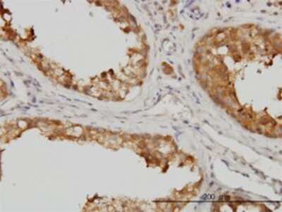 Immunohistochemistry-Paraffin: p38 delta/SAPK4 Antibody (2D8) [H00005603-M02]