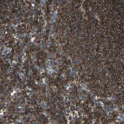 Immunohistochemistry-Paraffin: p38 delta/SAPK4 Antibody [NBP1-87373]