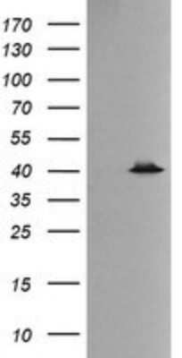 Western Blot: p38 delta/SAPK4 Antibody (OTI12B2)Azide and BSA Free [NBP2-73188]