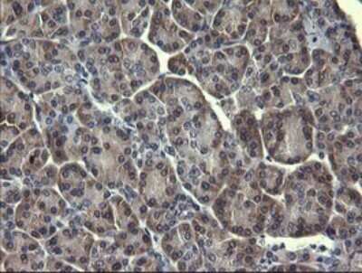 Immunohistochemistry: p38 delta/SAPK4 Antibody (OTI12B2) [NBP2-45742]
