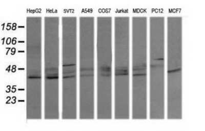 Western Blot: p38 delta/SAPK4 Antibody (OTI12B2) [NBP2-45742]