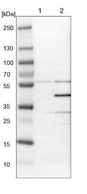 Western Blot: p38 delta/SAPK4 Antibody [NBP1-87373]