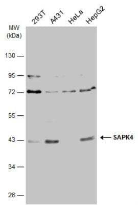 Western Blot: p38 delta/SAPK4 Antibody [NBP2-20260]