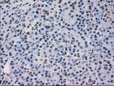 Immunohistochemistry: p38 gamma/SAPK3 Antibody (OTI10E1) - Azide and BSA Free [NBP2-73189]